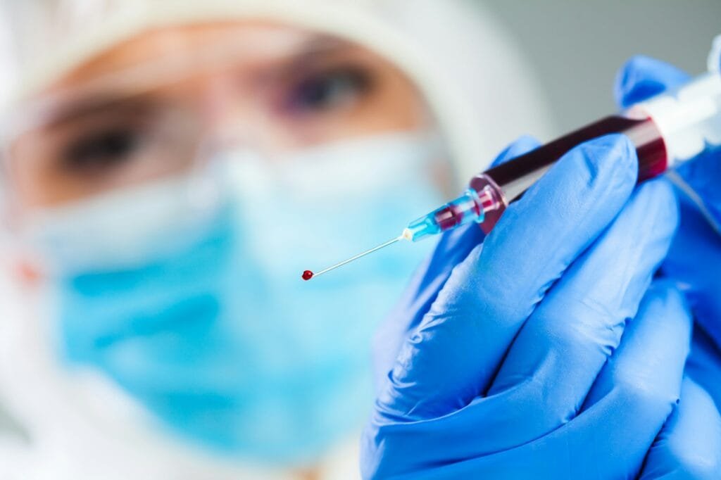 Doctor or lab scientist in personal protective equipment holding syringe full of PRP blood plasma